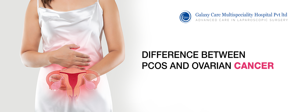 Understanding the Difference Between PCOS and Ovarian Cancer