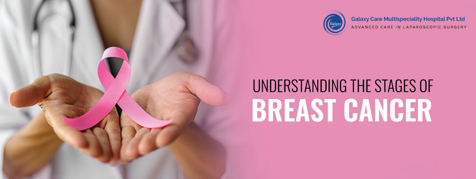 UNDERSTANDING THE STAGES OF BREAST CANCER